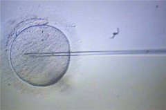 保养卵子和精子的办法