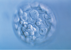 试管中胚胎质量和什么因素有关呢?武汉试管